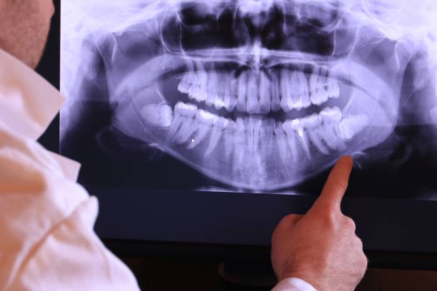 Best Emergency Tooth Extraction in Loch Lomond, VA